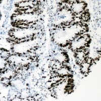 Polyclonal Rabbit anti-Human HNF4A / HNF4 Antibody (phospho-Ser313, IHC, IF, WB)