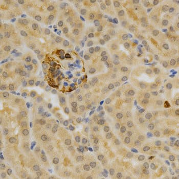 OPG / Osteoprotegerin Antibody