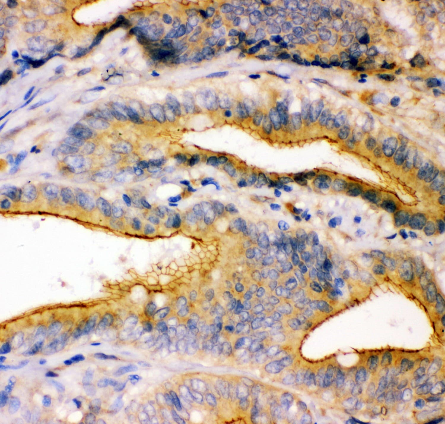 Polyclonal Rabbit anti-Human TJP1 / ZO-1 Antibody (aa1178-1527, IHC, WB)