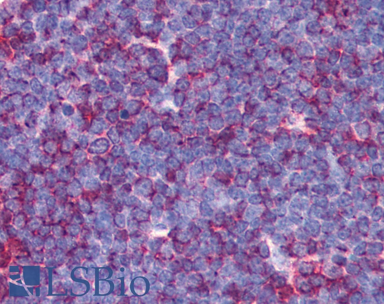 IHC-plus™ MAP3K7 / TAK1 Antibody