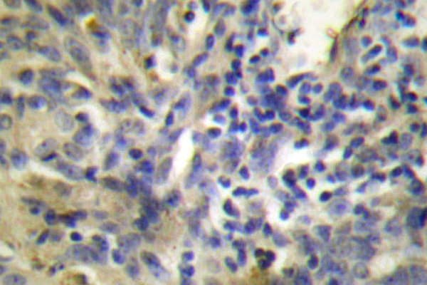 CSTA / Cystatin A Antibody (Gly84)
