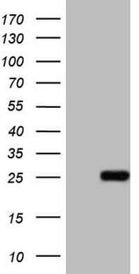 ABCC5 / MRP5 Antibody (clone OTI4B1)