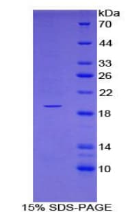 Human DeltaSIP Protein (Recombinant His-T7)