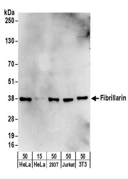IHC-plus™ FBL / FIB / Fibrillarin Antibody (aa1-50)