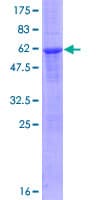 Human RNF144B Protein (Recombinant GST)