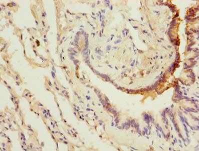LRRC8E Antibody (aa353-630)