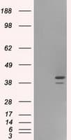 PathPlus™ NF45 / ILF2 Antibody (clone OTI6F1)