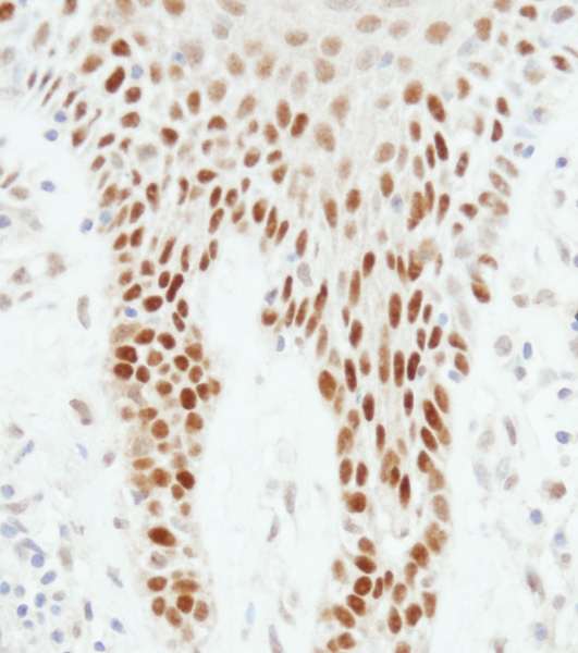 Polyclonal Rabbit anti-Human TP53 / p53 Antibody (aa50-100, IHC, WB)