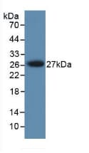 PRSS1 / Trypsin Antibody (aa51-228)