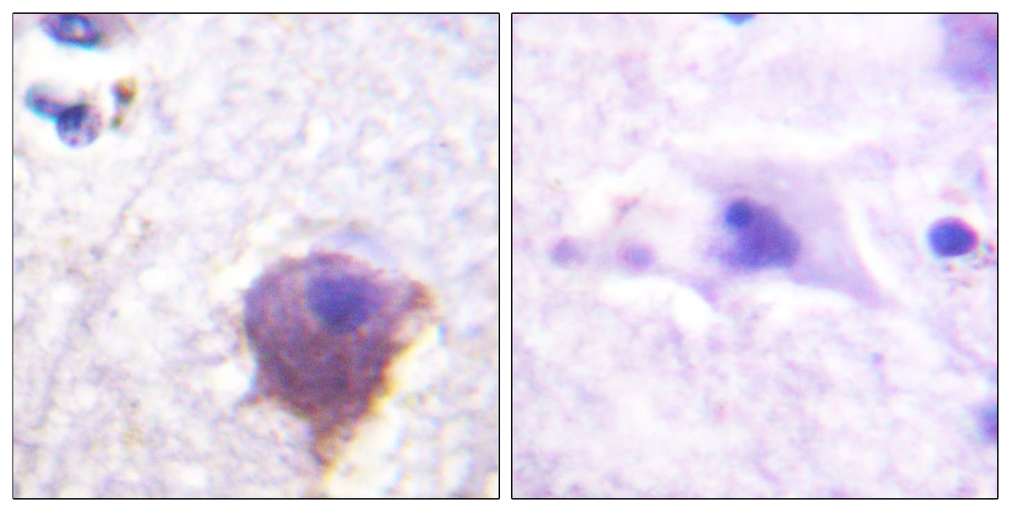 MAP4 Antibody (aa662-711)