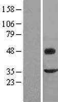 FMOD / Fibromodulin Protein (Over-Expression Lysate Myc-DDK (Flag))