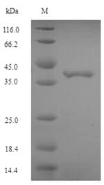 Escherichia coli EF-P Protein (Recombinant 6His-SUMO, N-terminus)