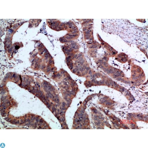Polyclonal Rabbit anti-Human IL37 Antibody (IHC)