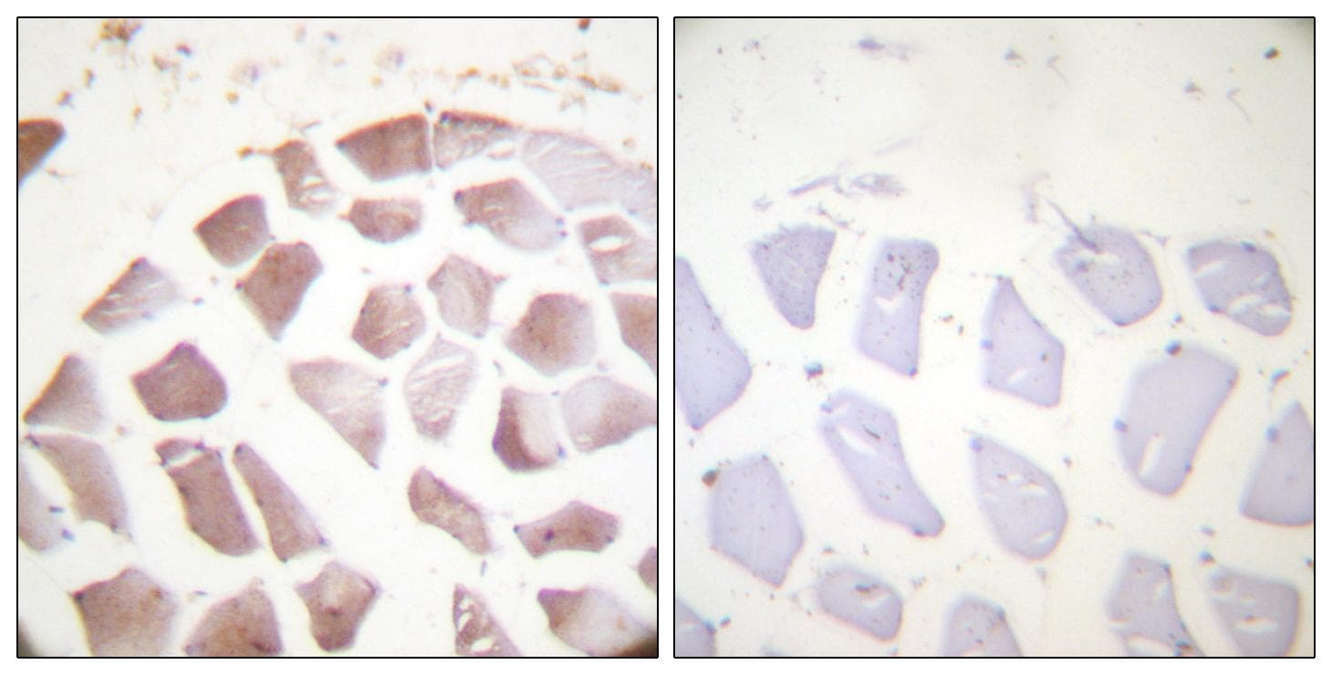 Polyclonal Rabbit anti-Human Actin Antibody (phospho-Tyr55/53, IHC)