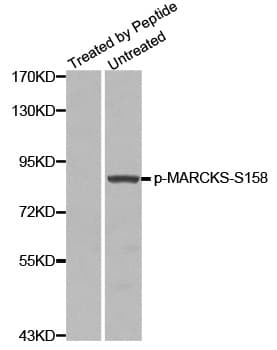 MARCKS Antibody (phospho-Ser158)