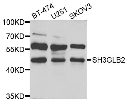 SH3GLB2 / Endophilin-B2 Antibody