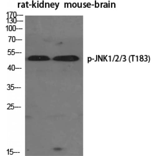 JNK1+2+3 Antibody (120-200 aa)