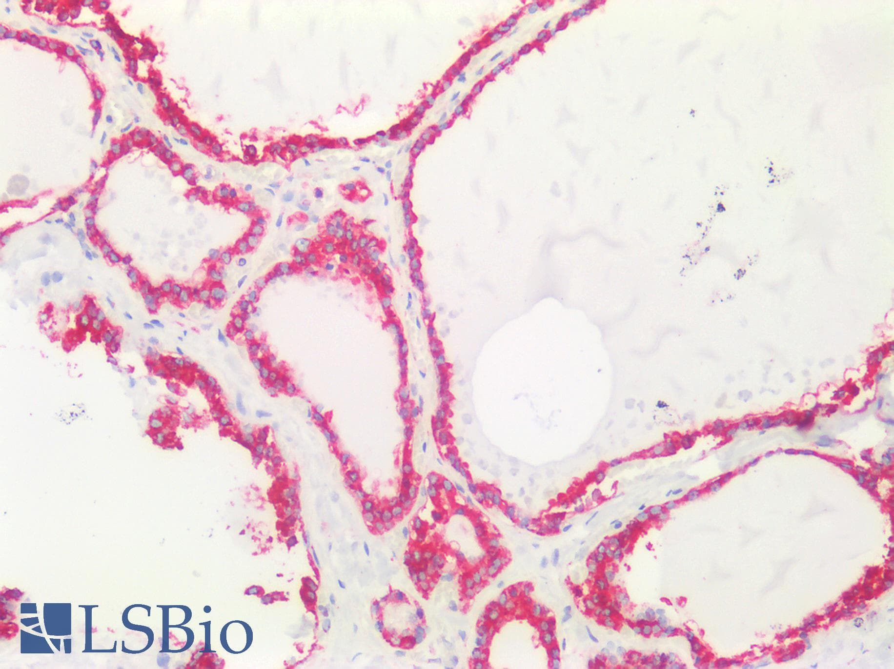IHC-plus™ HSPA5 / GRP78 / BiP Antibody (clone 1672CT323.22.82)