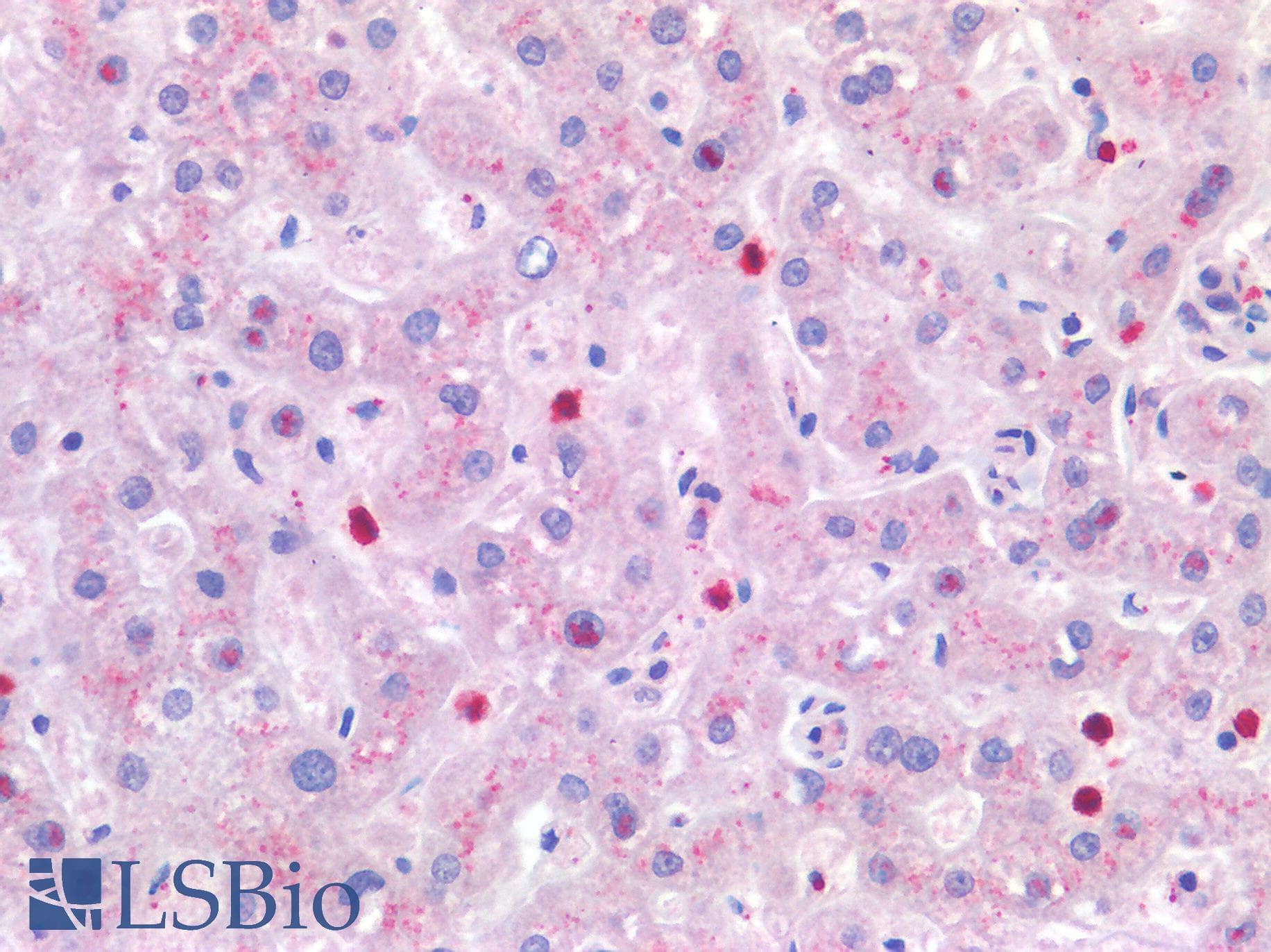 IHC-plus™ Polyclonal Rabbit anti-Human IL4 Antibody (IHC)