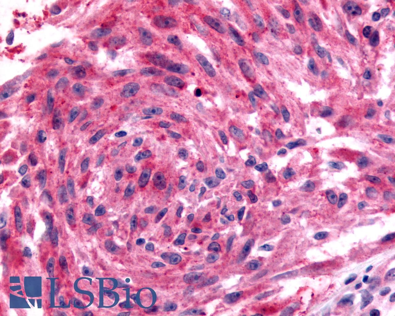 PathPlus™ Polyclonal Rabbit anti-Human GPR182 / ADMR Antibody (N-Terminus, IHC, WB)