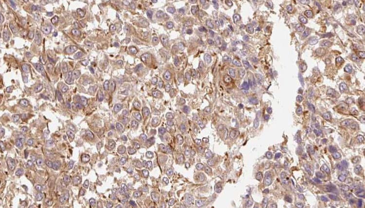FGF11 / FGF-11 Antibody