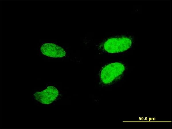 ATF2 Antibody (clone 1E12)