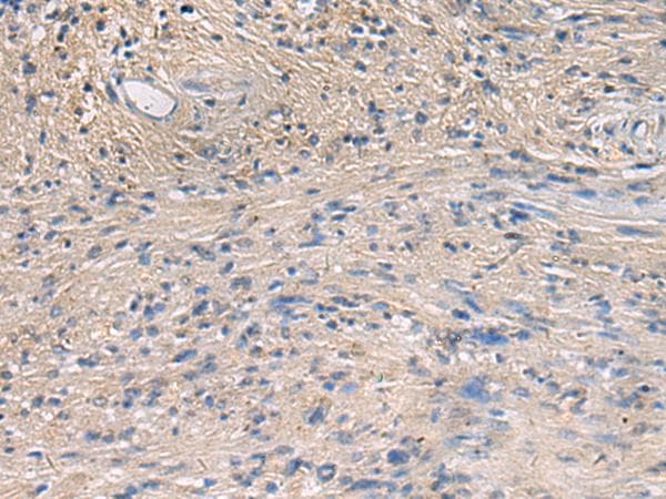 Polyclonal Rabbit anti-Human PA2G4 / EBP1 Antibody (IHC)
