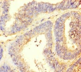 Polyclonal Rabbit anti-Human TTLL9 Antibody