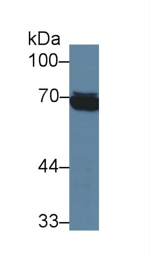 TPSAB1 / Mast Cell Tryptase Antibody (clone C16)