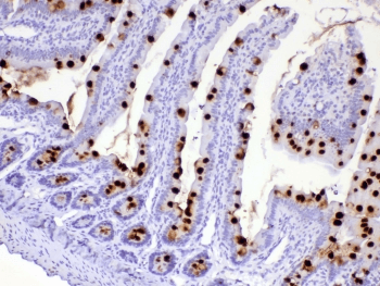 Polyclonal Rabbit anti-Human Mucin 2 / MUC2 Antibody (IHC)