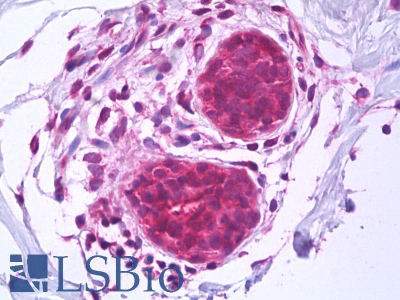 IHC-plus™ BAG1 / BAG-1 Antibody (clone 2D3)