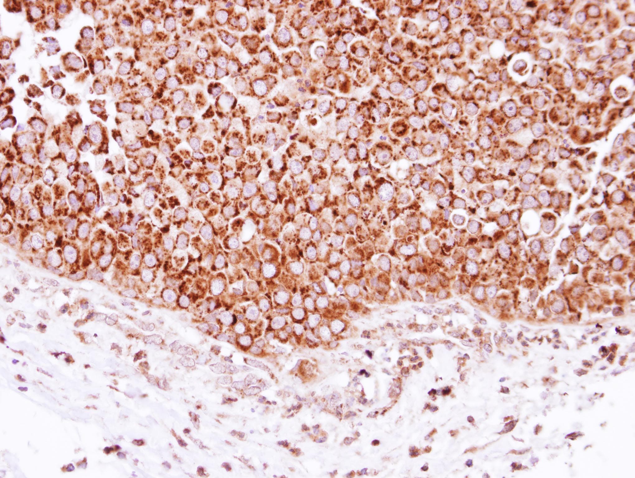 DECR1 Antibody