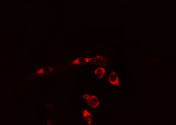 IL6ST / CD130 / gp130 Antibody