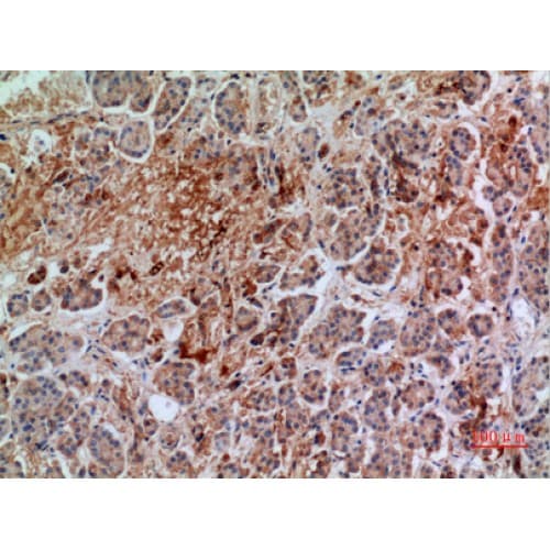 ANXA7 / Annexin VII / SNX Antibody (271-320 aa, Internal)