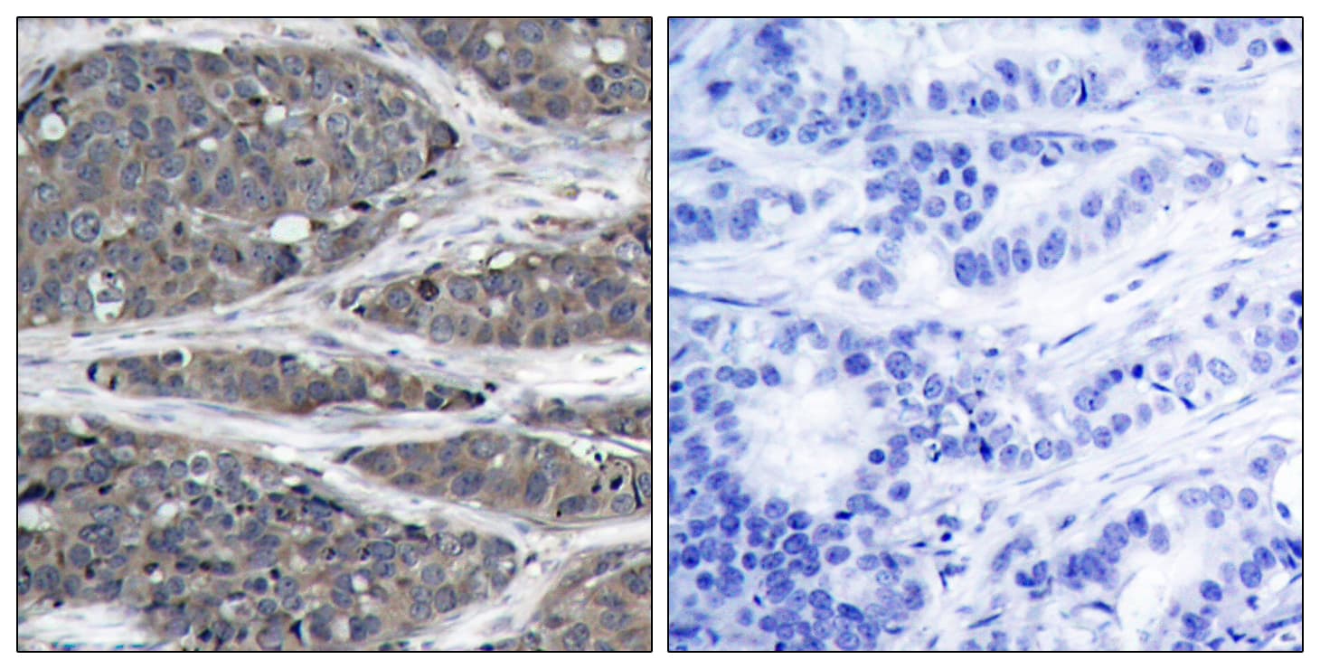 Polyclonal Rabbit anti-Human NFKB1 / NF-Kappa-B Antibody (aa899-948, IHC, WB)