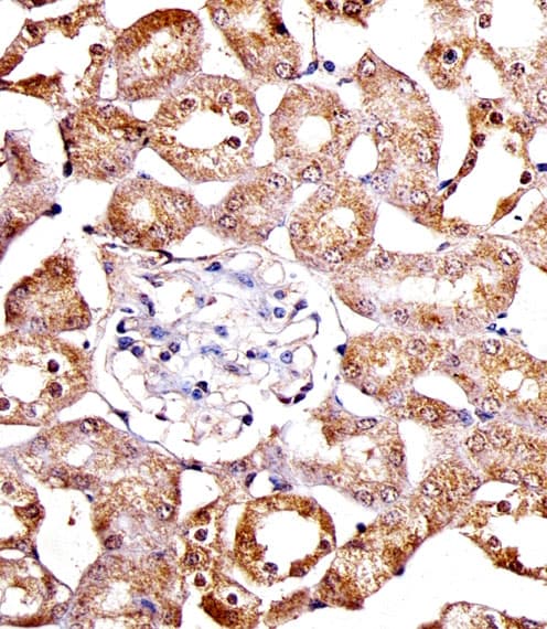 Polyclonal Rabbit anti-Human SPHK / SPHK1 Antibody (aa59-89, IHC, WB)