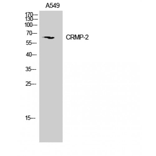 Polyclonal Rabbit anti-Human DPYSL2 / CRMP2 Antibody (450-530 aa, IHC, IF, WB)