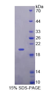 Human MYL6 Protein (Recombinant His-T7)