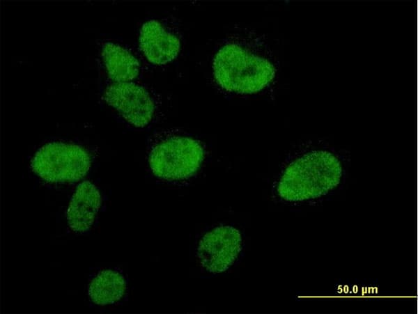 CREBBP / CREB Binding Protein Antibody (clone 2H5)
