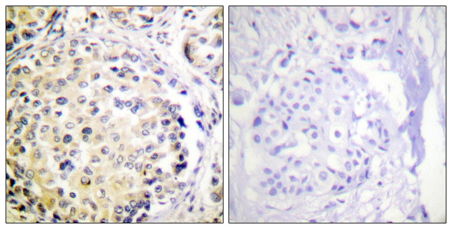 Polyclonal Rabbit anti-Human Vimentin Antibody (p56, IHC, WB)