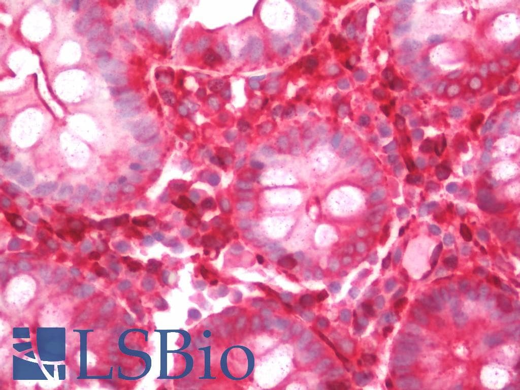 IHC-plus™ CDKN3 / KAP Antibody (clone 2E11)
