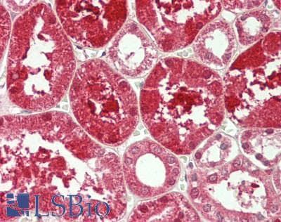IHC-plus™ Polyclonal Rabbit anti-Human PDGF-BB Antibody (IHC, WB)