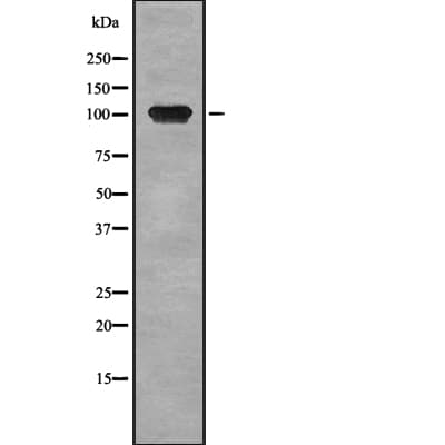OCRL Antibody