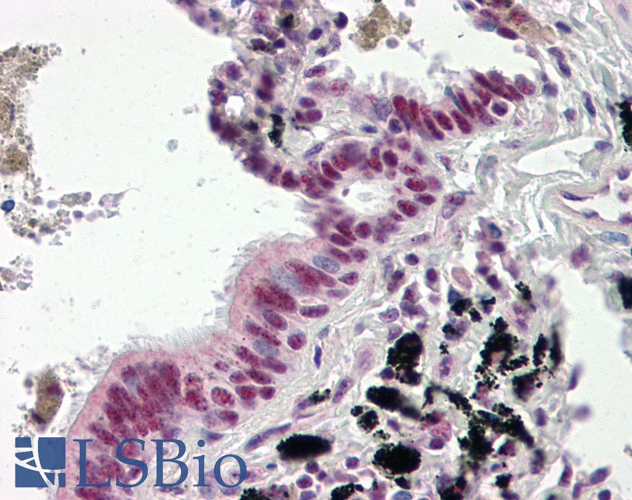 DNAJC3 / p58IPK Antibody
