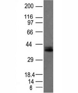 EPCAM Antibody (clone EGP40/1120)