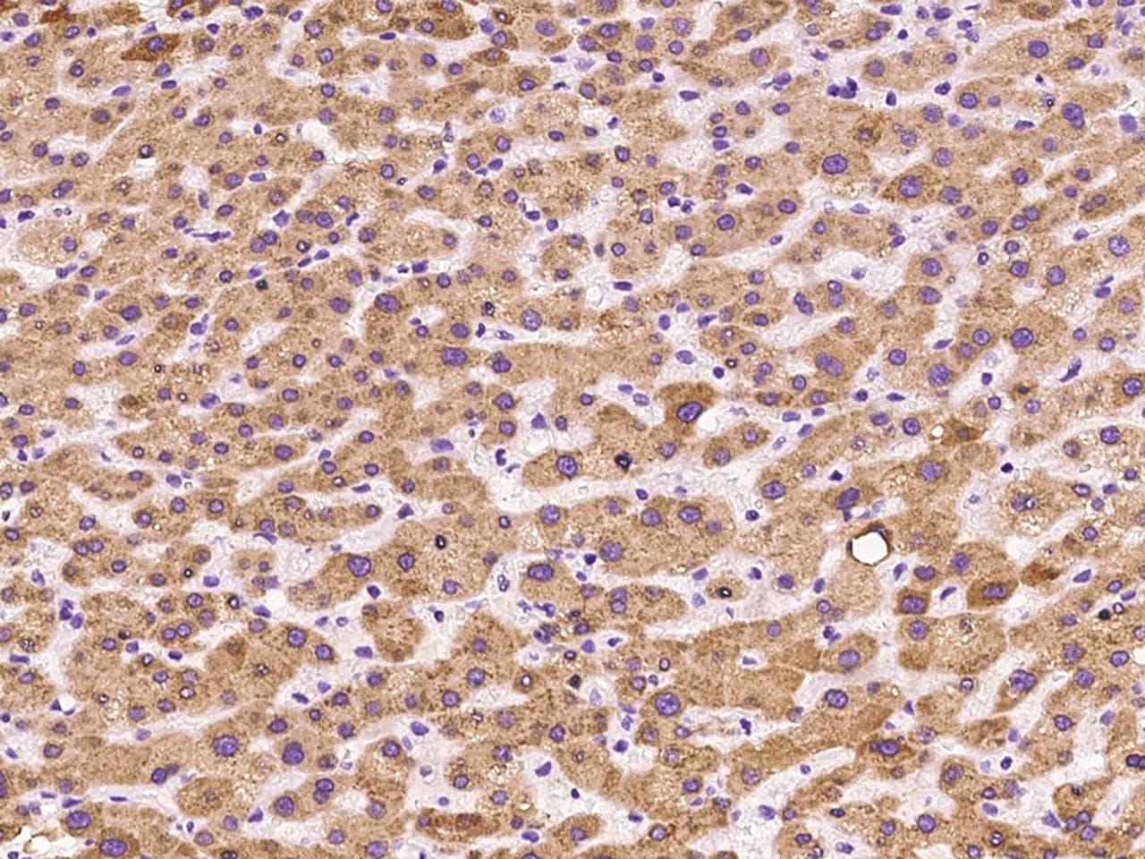 MGST1 Antibody