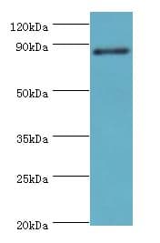 ADAM33 Antibody (aa140-420)