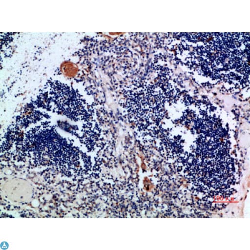 CSTA / Cystatin A Antibody