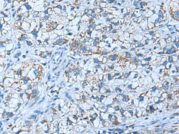 Polyclonal Rabbit anti-Human GCAP / GUCA1A Antibody (IHC)