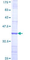 Human FBXW8 Protein (Recombinant GST, N-terminus)